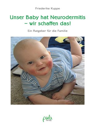cover image of Unser Baby hat Neurodermitis--wir schaffen das!
